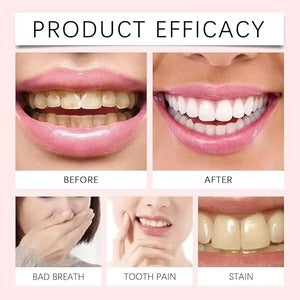 Oralhoe - Nicotinamide Dazzle White Toothpaste